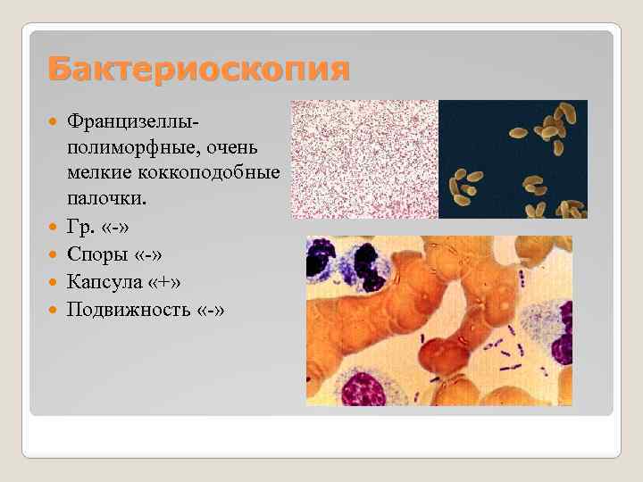 Бактериоскопия Францизеллы полиморфные, очень мелкие коккоподобные палочки. Гр. « » Споры « » Капсула
