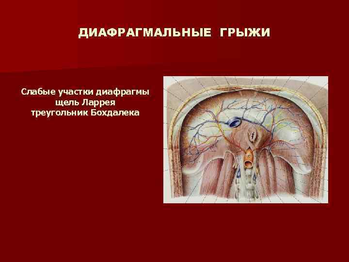 Заболевания диафрагмы презентация