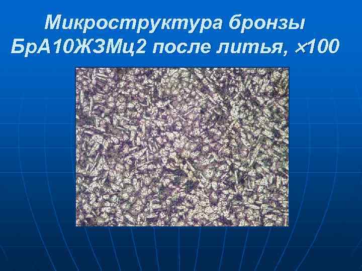 Микроструктура бронзы Бр. А 10 ЖЗМц2 после литья, 100 