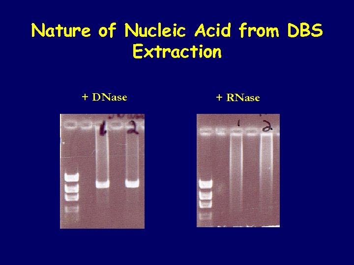 Nature of Nucleic Acid from DBS Extraction + DNase + RNase 