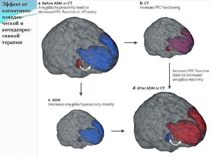 Эффект от когнитивноповеденческой и антидепрессивной терапии 