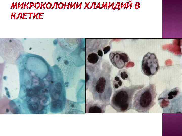 МИКРОКОЛОНИИ ХЛАМИДИЙ В КЛЕТКЕ 