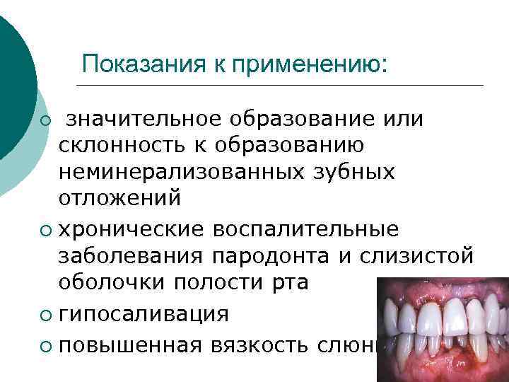 Показания к применению: значительное образование или склонность к образованию неминерализованных зубных отложений ¡ хронические