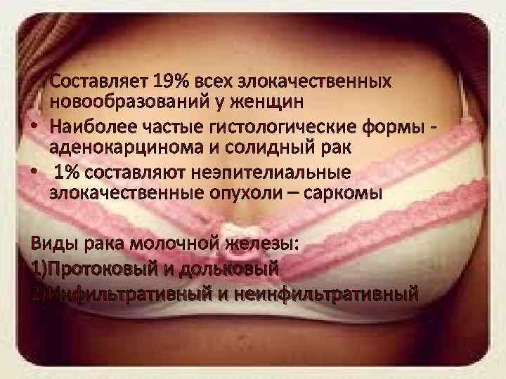  • Составляет 19% всех злокачественных новообразований у женщин • Наиболее частые гистологические формы