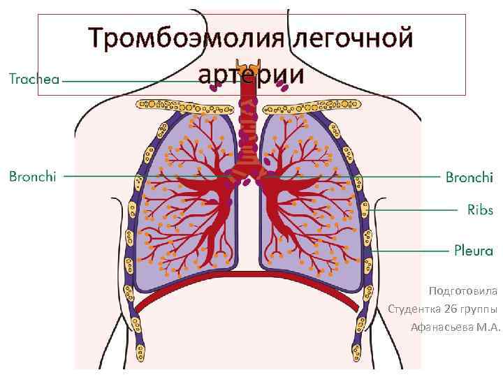 Тромбоэмолия легочной артерии Подготовила Студентка 26 группы Афанасьева М. А. 