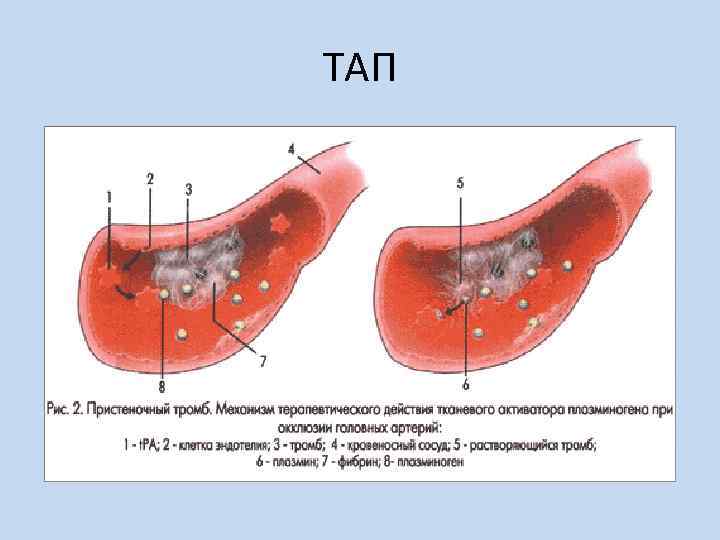 ТАП 