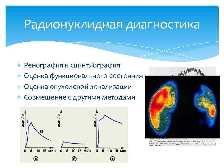 Радионуклидная диагностика Ренография и сцинтиография Оценка функционального состояния Оценка опухолевой локализации Совмещение с другими