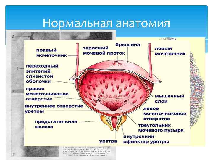 Нормальная анатомия Почки, мочеточники, мочевой пузырь, уретра На уровне XII грудного – II пояничного