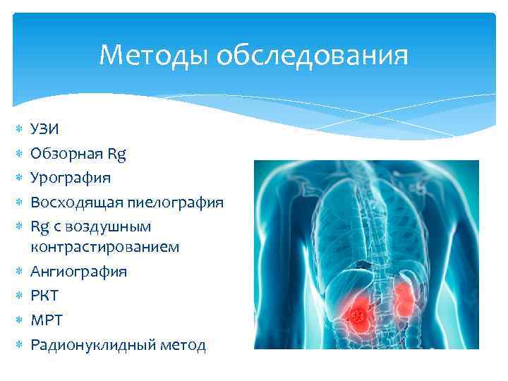 Методы обследования УЗИ Обзорная Rg Урография Восходящая пиелография Rg с воздушным контрастированием Ангиография РКТ