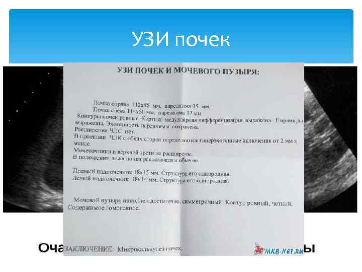 УЗИ почек Первая инстранция, скрининг Множество показаний Негазированная диета Лежа на спине, на боку,