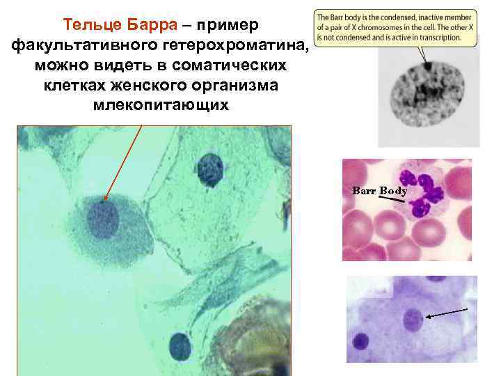 Тельце Барра – пример факультативного гетерохроматина, можно видеть в соматических клетках женского организма млекопитающих