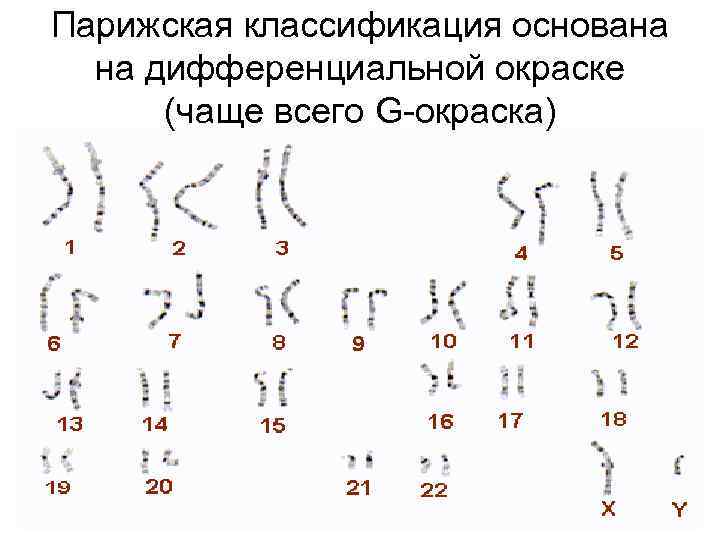 Парижская классификация основана на дифференциальной окраске (чаще всего G-окраска) 