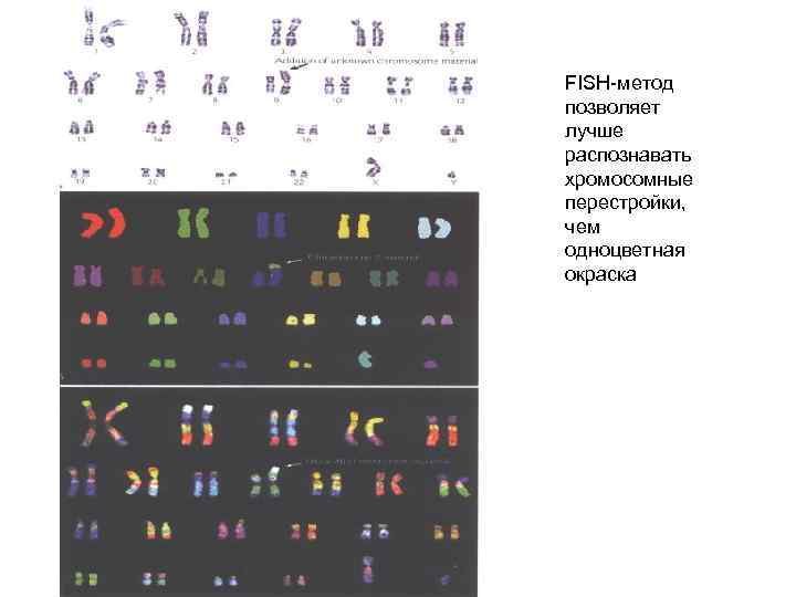 FISH-метод позволяет лучше распознавать хромосомные перестройки, чем одноцветная окраска 