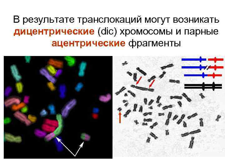 В результате транслокаций могут возникать дицентрические (dic) хромосомы и парные ацентрические фрагменты 