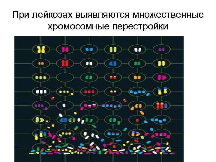 При лейкозах выявляются множественные хромосомные перестройки 