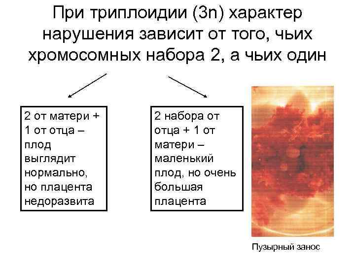 При триплоидии (3 n) характер нарушения зависит от того, чьих хромосомных набора 2, а