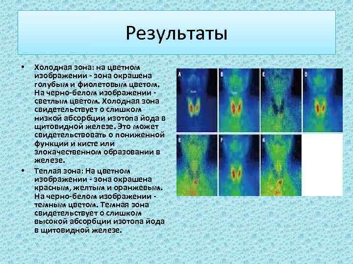 Результаты • • Холодная зона: на цветном изображении - зона окрашена голубым и фиолетовым