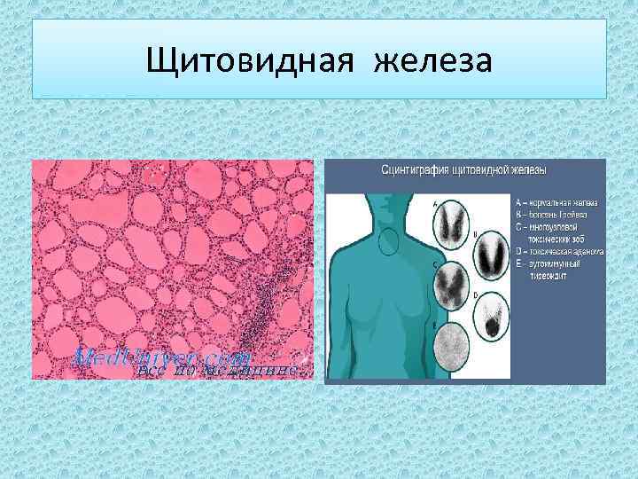 Диагностика щитовидной железы презентация