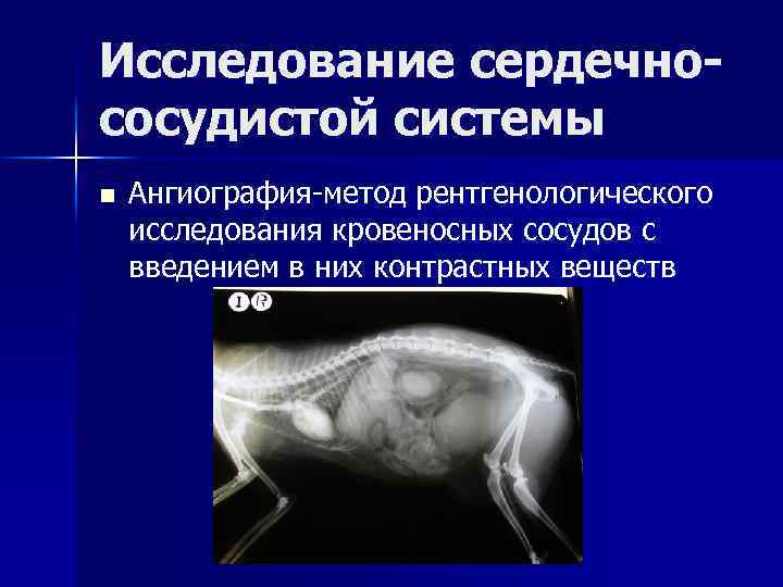 Исследование сердечнососудистой системы n Ангиография-метод рентгенологического исследования кровеносных сосудов с введением в них контрастных