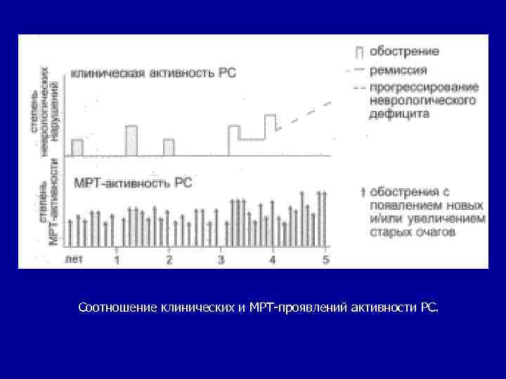  Соотношение клинических и МРТ-проявлений активности РС. 