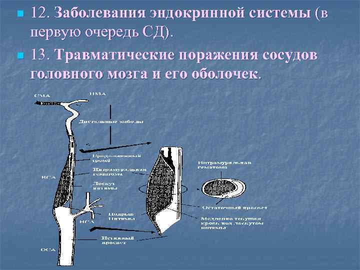 n n 12. Заболевания эндокринной системы (в первую очередь СД). 13. Травматические поражения сосудов