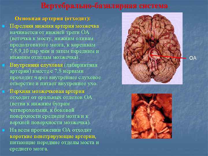 Вертебрально-базилярная система n n Основная артерия (отходят): Передняя нижняя артерия мозжечка начинается от нижней