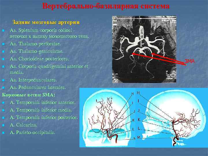 Средняя мозговая артерия. Средняя мозговая артерия сегменты и ветви. Сегменты задней мозговой артерии. Сегменты основной артерии головного мозга. Веточки средней мозговой артерии.