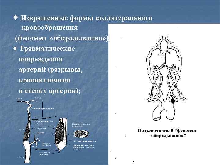 ♦ Извращенные формы коллатерального кровообращения (феномен «обкрадывания» ); ♦ Травматические повреждения артерий (разрывы, кровоизлияния