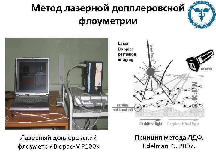 Метод лазерной допплеровской флоуметрии Лазерный доплеровский флоуметр «Biopac-MP 100» Принцип метода ЛДФ. Edelman P.