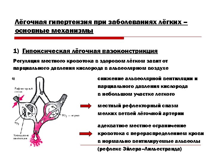 Лёгочная гипертензия при заболеваниях лёгких – основные механизмы 1) Гипоксическая лёгочная вазоконстрикция Регуляция местного