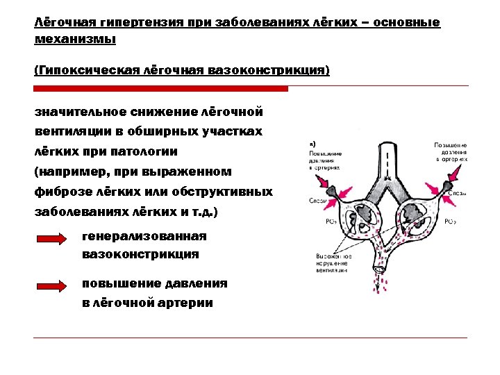 Лёгочная гипертензия при заболеваниях лёгких – основные механизмы (Гипоксическая лёгочная вазоконстрикция) значительное снижение лёгочной