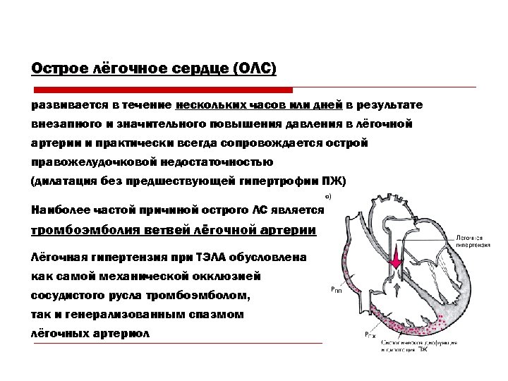 Острое лёгочное сердце (ОЛС) развивается в течение нескольких часов или дней в результате внезапного