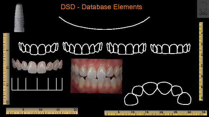 DSD - Database Elements 