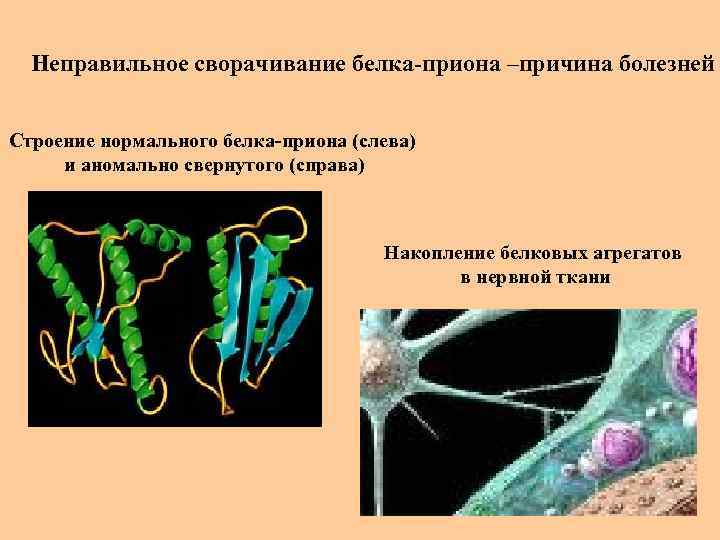 Неправильное сворачивание белка-приона –причина болезней Строение нормального белка-приона (слева) и аномально свернутого (справа) Накопление