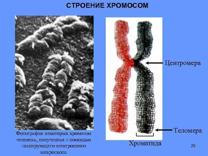СТРОЕНИЕ ХРОМОСОМ Центромера Фотография некоторых хромосом человека, полученная с помощью сканирующего электронного микроскопа Теломера