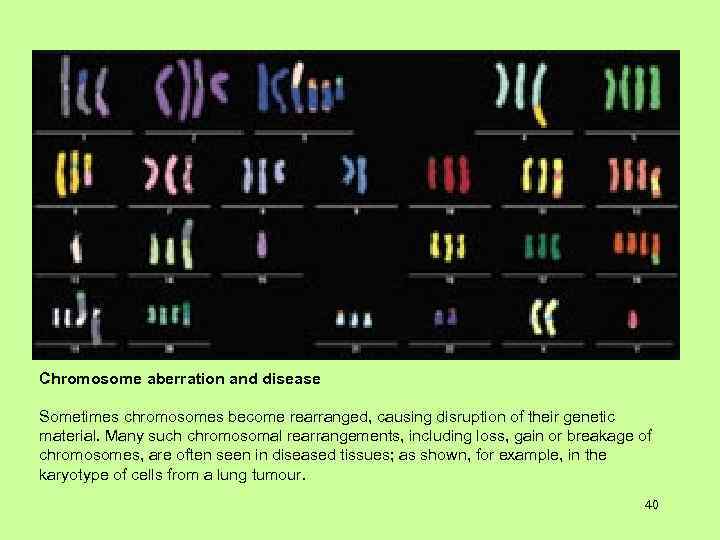 Chromosome aberration and disease Sometimes chromosomes become rearranged, causing disruption of their genetic material.