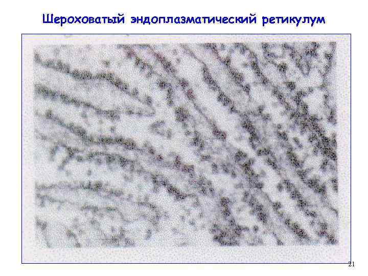 Шероховатый эндоплазматический ретикулум 21 