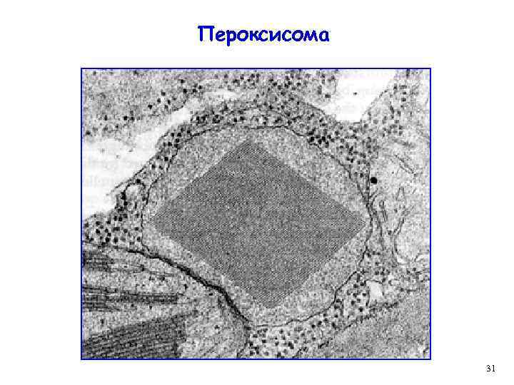 Пероксисома 31 