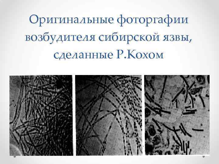 Оригинальные фоторгафии возбудителя сибирской язвы, сделанные Р. Кохом 
