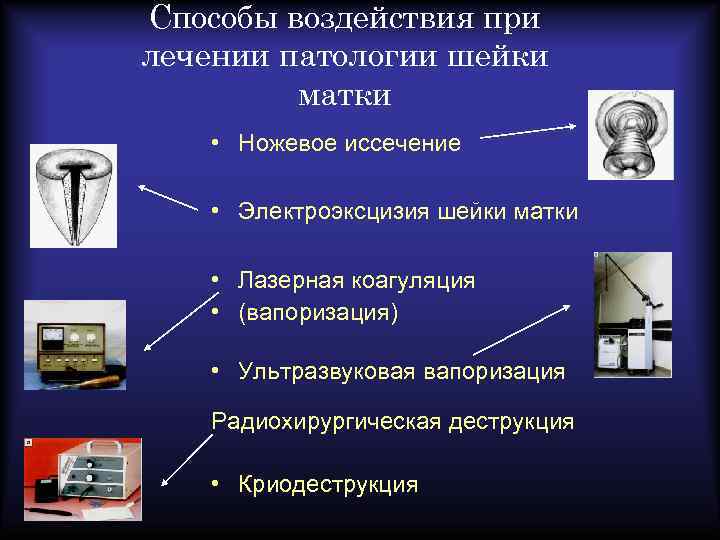 Способы воздействия при лечении патологии шейки матки • Ножевое иссечение • Электроэксцизия шейки матки