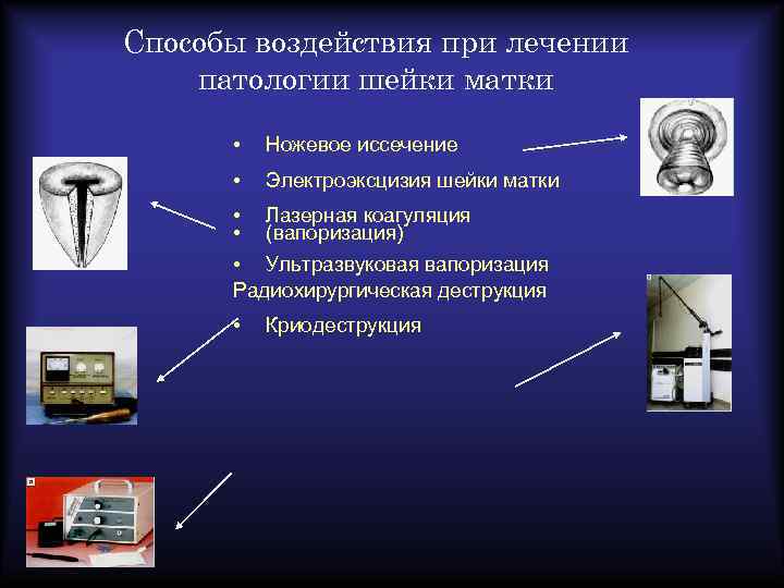 Способы воздействия при лечении патологии шейки матки • Ножевое иссечение • Электроэксцизия шейки матки