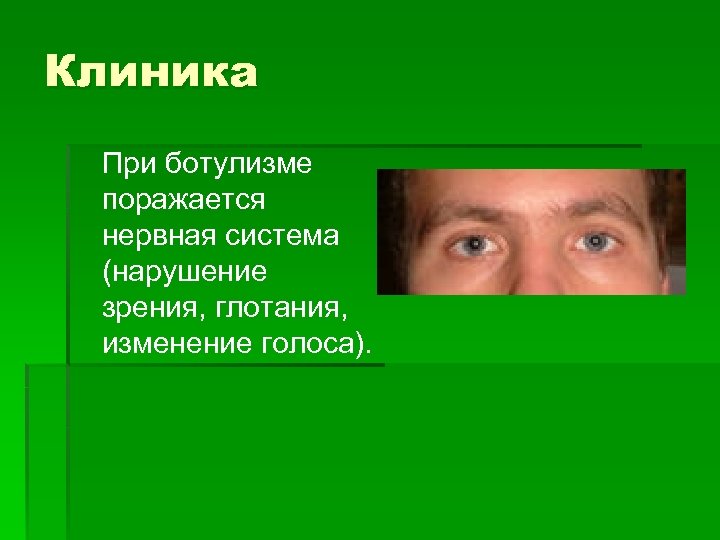 Клиника При ботулизме поражается нервная система (нарушение зрения, глотания, изменение голоса). 