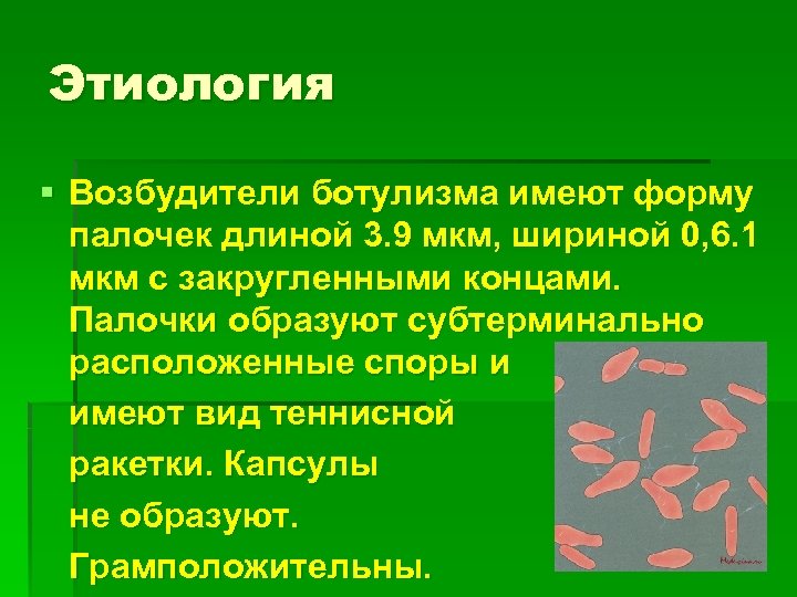 Этиология § Возбудители ботулизма имеют форму палочек длиной 3. 9 мкм, шириной 0, 6.