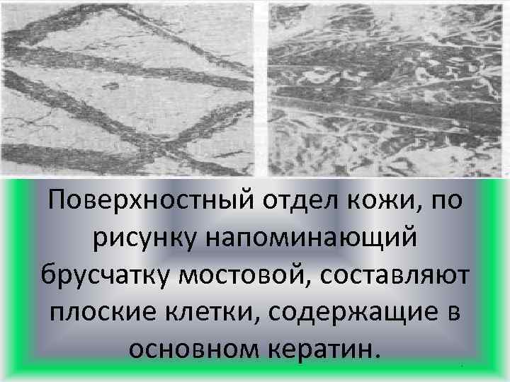 Поверхностный отдел кожи, по рисунку напоминающий брусчатку мостовой, составляют плоские клетки, содержащие в основном