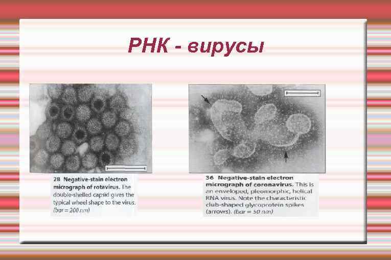 РНК - вирусы 