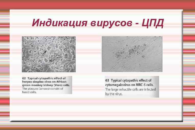 Цпд это микробиология