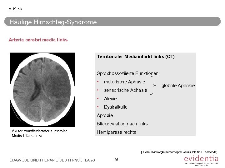 Essential Slide Kit Diagnose Und Therapie Des Hirnschlags