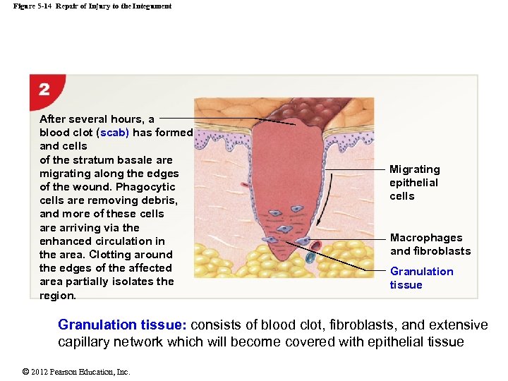 Figure 5 -14 Repair of Injury to the Integument After several hours, a blood