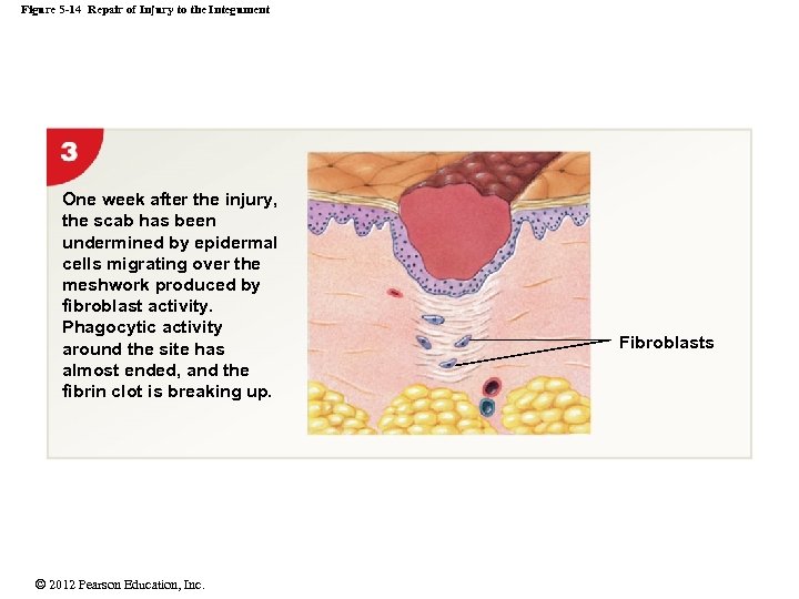 Figure 5 -14 Repair of Injury to the Integument One week after the injury,