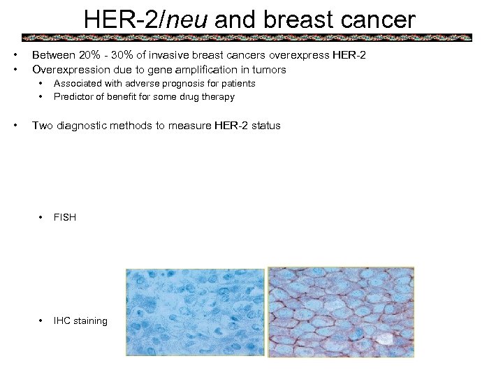HER-2/neu and breast cancer • • Between 20% - 30% of invasive breast cancers